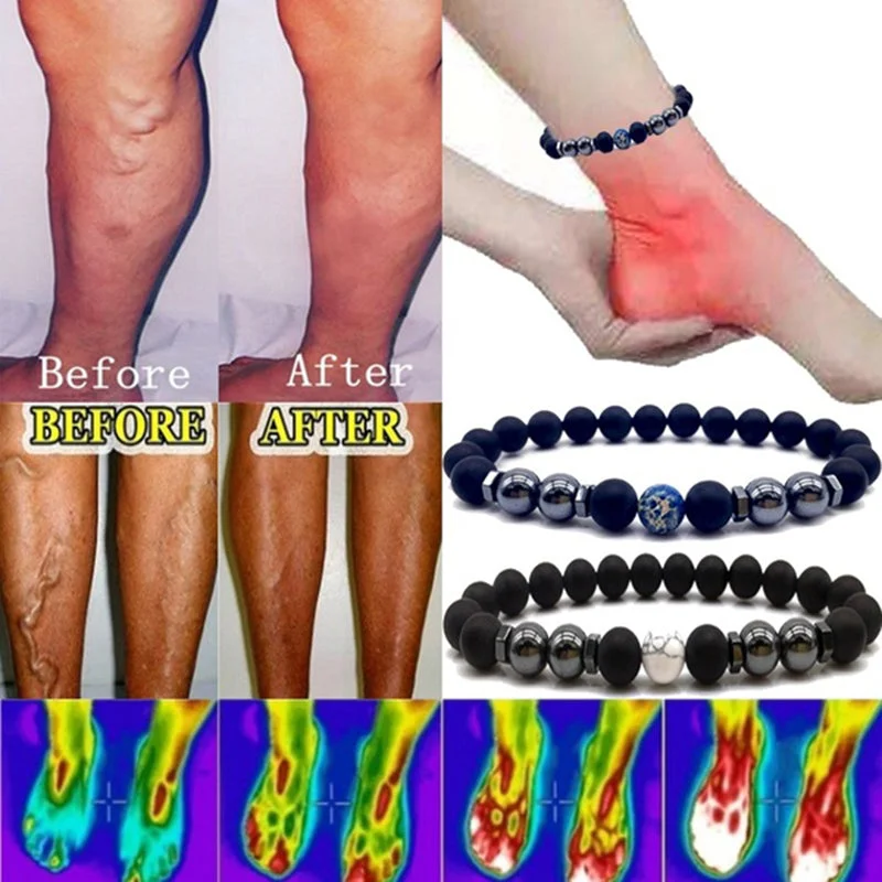 Exclusive Jewelry Bundles At Discounted Rates Varicose Veins Free Offer